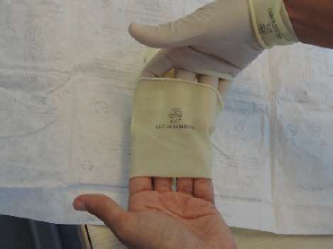 Colocación de guantes estériles